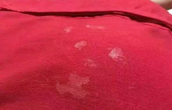 結構膠粘衣服上用什么能洗掉,結構膠怎樣清除在衣服上圖2