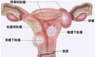 縮陰方法有哪些虹橋醫院網(wǎng)址