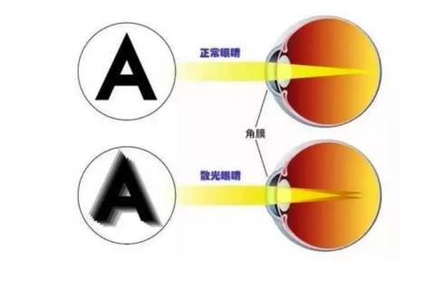 散光,注意事項,眼鏡