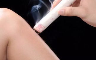 艾灸后注意事項,艾灸做完后的注意事項,艾灸后注意事項和禁忌癥