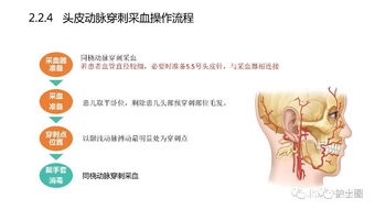 血氣,標本,時(shí)應,注意事項