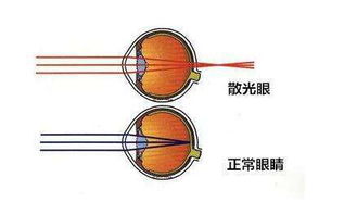 散光配眼鏡的注意事項