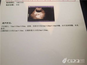 女性查體前一天注意事項(xiàng),女性b超檢查注意事項(xiàng),女性做b超注意事項(xiàng)