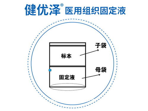 常用固定液的種類及注意事項