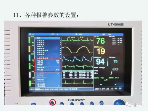 心電監護儀使用注意事項