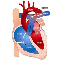 嬰兒肺動(dòng)脈高壓應(yīng)注意事項(xiàng)
