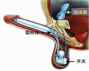 假體隆胸術(shù)后注意事項,假體下巴術(shù)后注意事項,假體下巴術(shù)后注意事項及護理