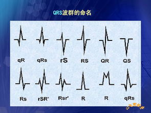 心電圖,基礎知識,講解,PPT